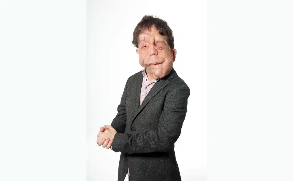 Adam Pearson